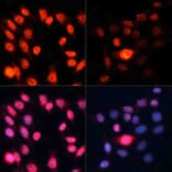 Immunofluorescence - Anti-S6K1 (phospho Thr389) Antibody (A11042) - Antibodies.com