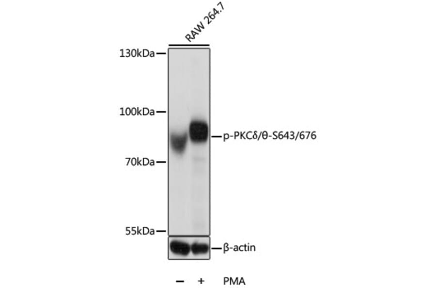Western Blot - Anti-PKC delta + PKC theta/PRKCQ (phospho Ser643 + Ser676) Antibody (A11045) - Antibodies.com