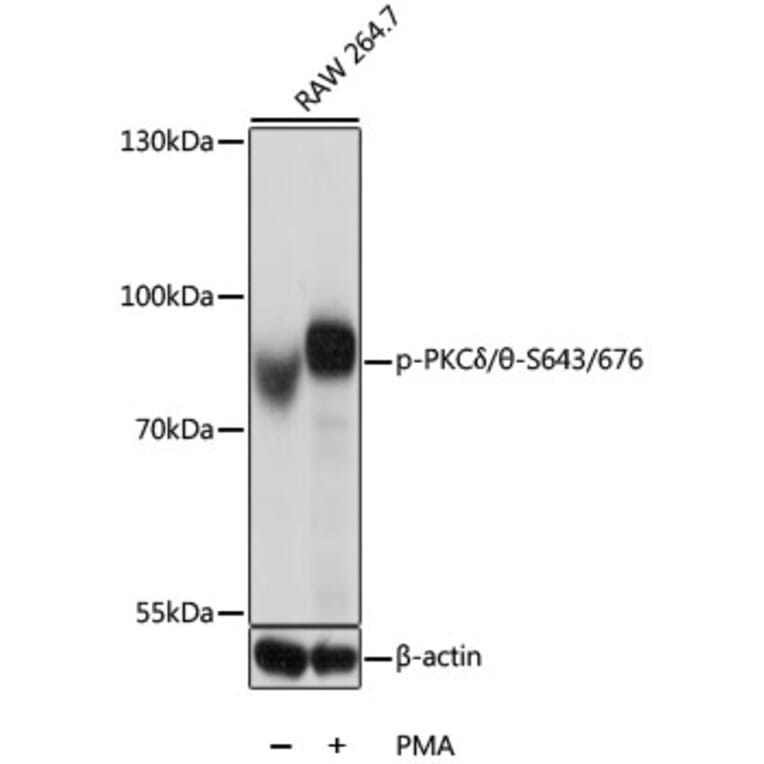 Western Blot - Anti-PKC delta + PKC theta/PRKCQ (phospho Ser643 + Ser676) Antibody (A11045) - Antibodies.com