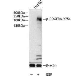 Western Blot - Anti-PDGFR alpha (phospho Tyr754) Antibody (A11046) - Antibodies.com