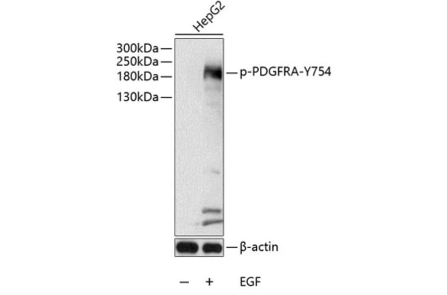 Western Blot - Anti-PDGFR alpha (phospho Tyr754) Antibody (A11046) - Antibodies.com