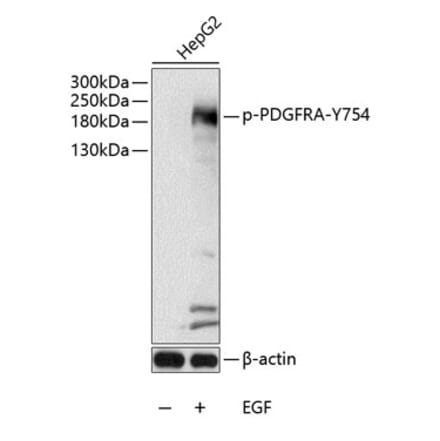 Western Blot - Anti-PDGFR alpha (phospho Tyr754) Antibody (A11046) - Antibodies.com