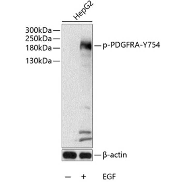 Western Blot - Anti-PDGFR alpha (phospho Tyr754) Antibody (A11046) - Antibodies.com