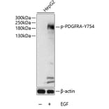 Western Blot - Anti-PDGFR alpha (phospho Tyr754) Antibody (A11046) - Antibodies.com