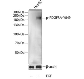Western Blot - Anti-PDGFR alpha (phospho Tyr849) Antibody (A11047) - Antibodies.com
