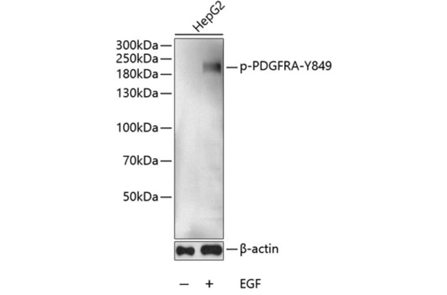 Western Blot - Anti-PDGFR alpha (phospho Tyr849) Antibody (A11047) - Antibodies.com