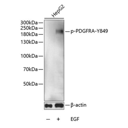 Western Blot - Anti-PDGFR alpha (phospho Tyr849) Antibody (A11047) - Antibodies.com