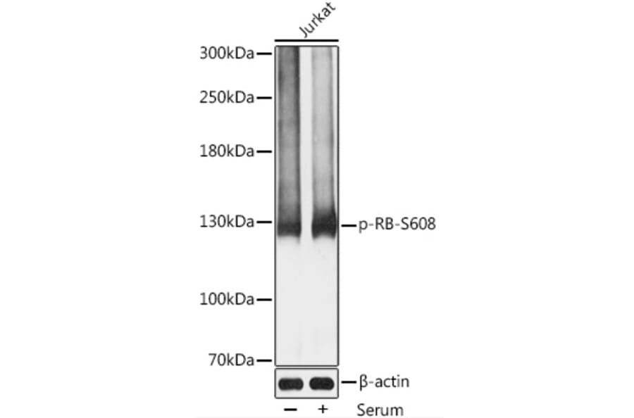 Western Blot - Anti-Rb (phospho Ser608) Antibody (A11048) - Antibodies.com