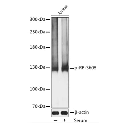 Western Blot - Anti-Rb (phospho Ser608) Antibody (A11048) - Antibodies.com