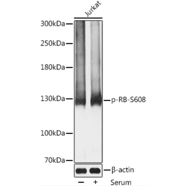 Western Blot - Anti-Rb (phospho Ser608) Antibody (A11048) - Antibodies.com