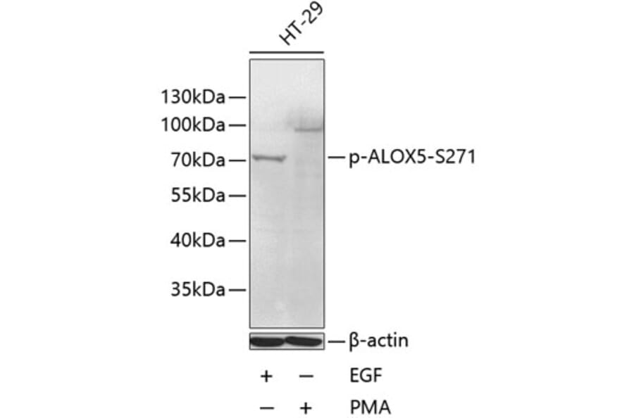Western Blot - Anti-5 Lipoxygenase/5-LO (phospho Ser271) Antibody (A11051) - Antibodies.com