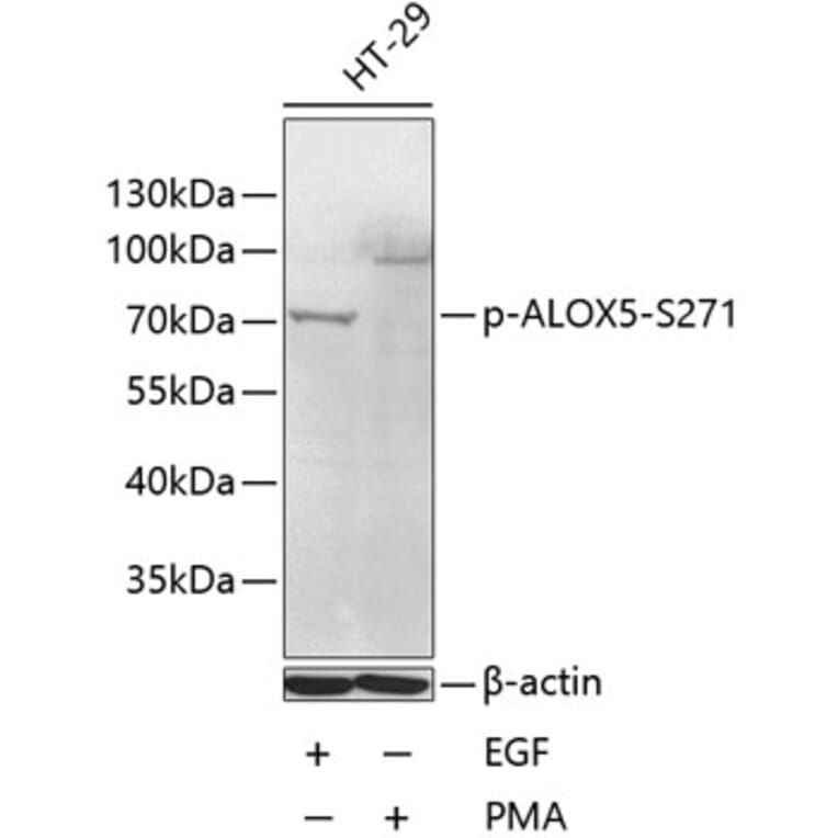 Western Blot - Anti-5 Lipoxygenase/5-LO (phospho Ser271) Antibody (A11051) - Antibodies.com
