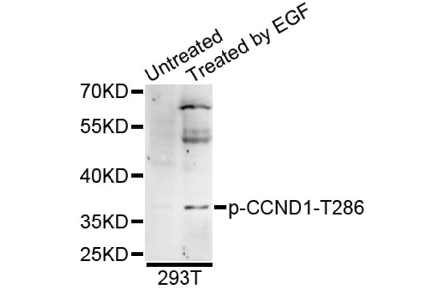 Western Blot - Anti-CCND1 (phospho T286) Antibody (AP0574) - Antibodies.com
