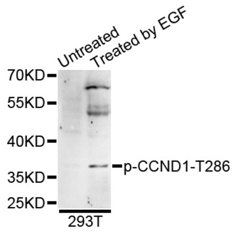Western Blot - Anti-CCND1 (phospho T286) Antibody (AP0574) - Antibodies.com