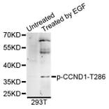 Western Blot - Anti-CCND1 (phospho T286) Antibody (AP0574) - Antibodies.com