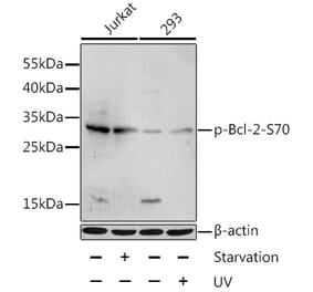 Western Blot - Anti-Bcl-2 (phospho Ser70) Antibody (A11053) - Antibodies.com