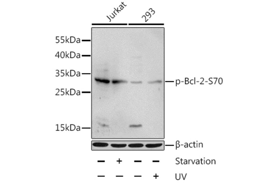 Western Blot - Anti-Bcl-2 (phospho Ser70) Antibody (A11053) - Antibodies.com