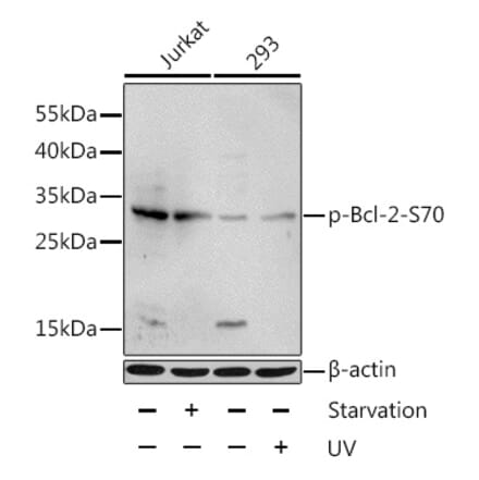 Western Blot - Anti-Bcl-2 (phospho Ser70) Antibody (A11053) - Antibodies.com