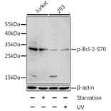 Western Blot - Anti-Bcl-2 (phospho Ser70) Antibody (A11053) - Antibodies.com