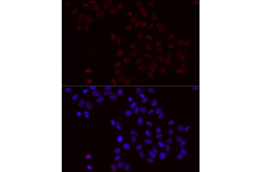 Immunofluorescence - Anti-Bcl-2 (phospho Ser70) Antibody (A11053) - Antibodies.com