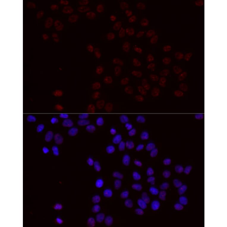 Immunofluorescence - Anti-Bcl-2 (phospho Ser70) Antibody (A11053) - Antibodies.com