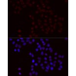 Immunofluorescence - Anti-Bcl-2 (phospho Ser70) Antibody (A11053) - Antibodies.com