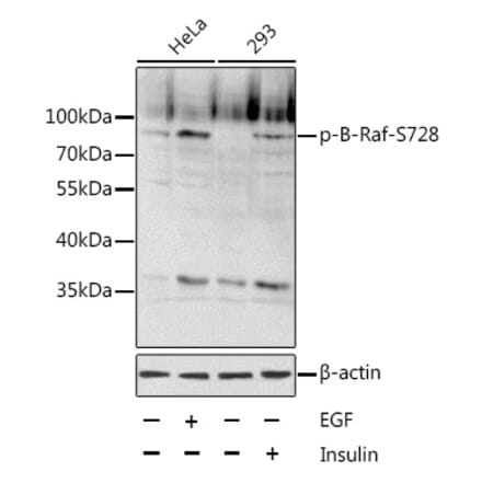 Western Blot - Anti-BRAF (phospho Ser728) Antibody (A11054) - Antibodies.com
