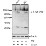 Western Blot - Anti-BRAF (phospho Ser728) Antibody (A11054) - Antibodies.com