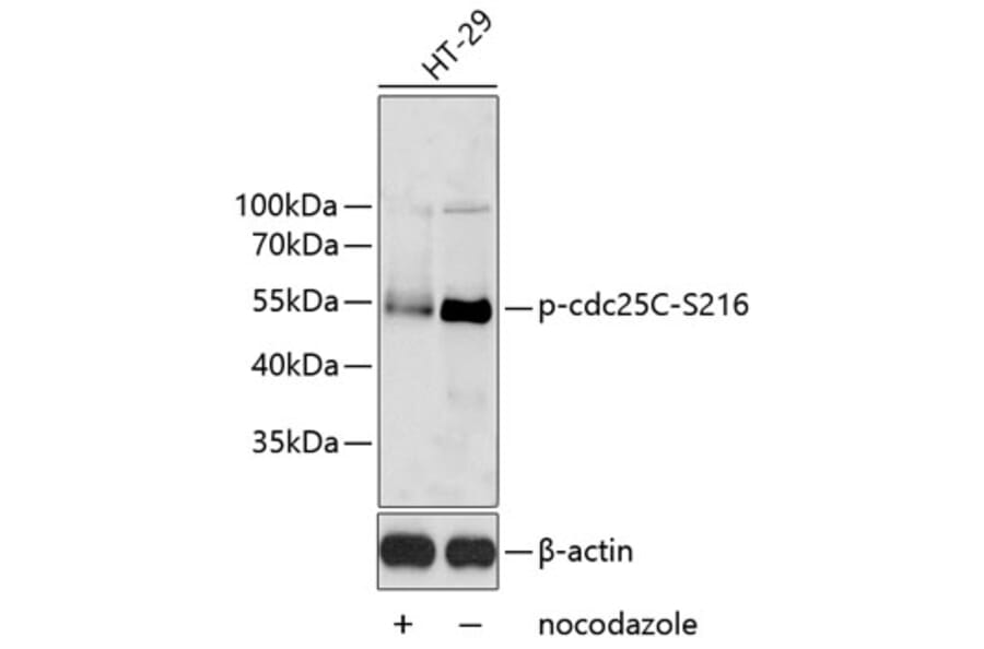 Western Blot - Anti-Cdc25C (phospho Ser216) Antibody (A11055) - Antibodies.com