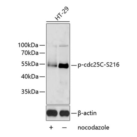 Western Blot - Anti-Cdc25C (phospho Ser216) Antibody (A11055) - Antibodies.com