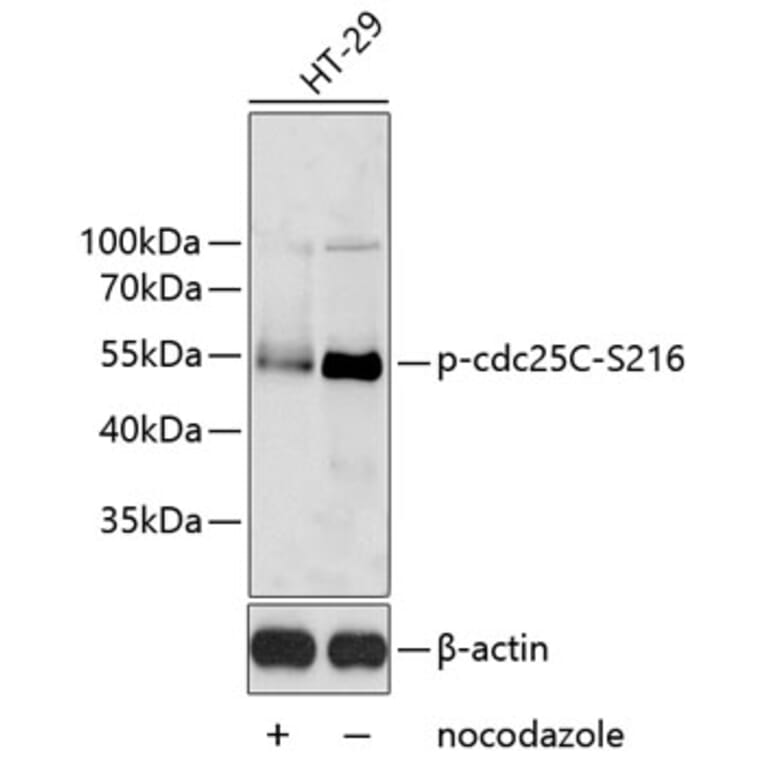 Western Blot - Anti-Cdc25C (phospho Ser216) Antibody (A11055) - Antibodies.com