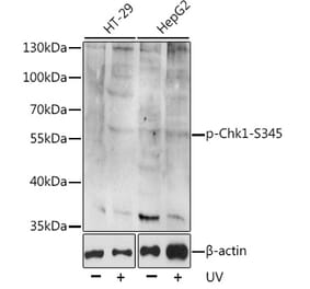 Western Blot - Anti-Chk1 (phospho Ser345) Antibody (A11056) - Antibodies.com