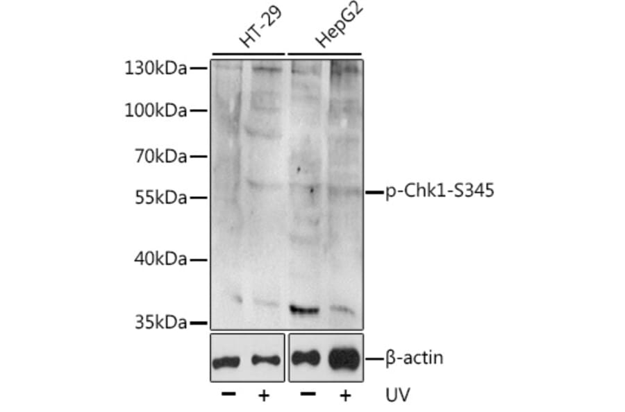 Western Blot - Anti-Chk1 (phospho Ser345) Antibody (A11056) - Antibodies.com