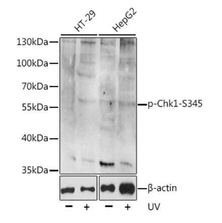 Western Blot - Anti-Chk1 (phospho Ser345) Antibody (A11056) - Antibodies.com