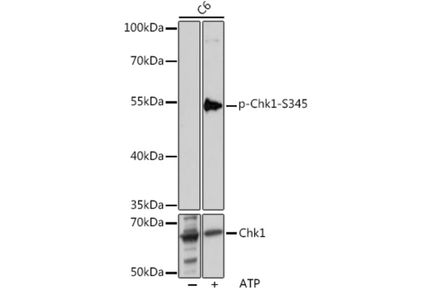 Western Blot - Anti-Chk1 (phospho Ser345) Antibody (A11056) - Antibodies.com