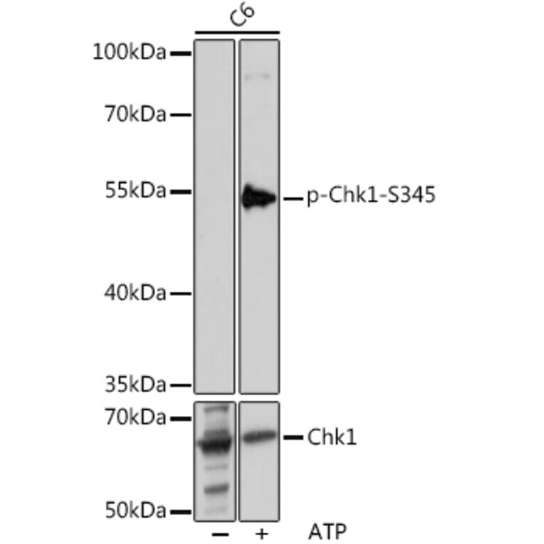 Western Blot - Anti-Chk1 (phospho Ser345) Antibody (A11056) - Antibodies.com