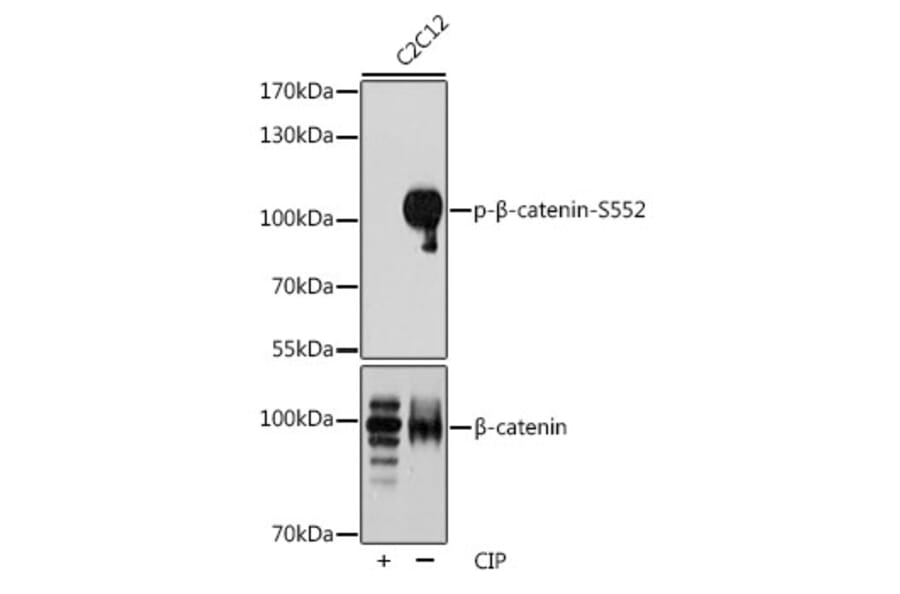 Western Blot - Anti-beta Catenin (phospho Ser552) Antibody (A11057) - Antibodies.com