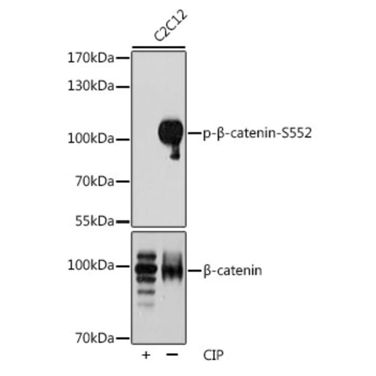 Western Blot - Anti-beta Catenin (phospho Ser552) Antibody (A11057) - Antibodies.com