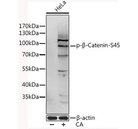 Western Blot - Anti-beta Catenin (phospho Ser45) Antibody (A11058) - Antibodies.com