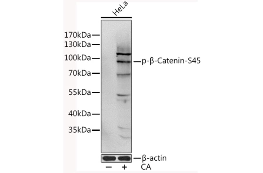 Western Blot - Anti-beta Catenin (phospho Ser45) Antibody (A11058) - Antibodies.com