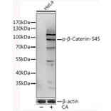 Western Blot - Anti-beta Catenin (phospho Ser45) Antibody (A11058) - Antibodies.com