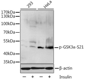 Western Blot - Anti-GSK3 alpha (phospho Ser21) Antibody (A11060) - Antibodies.com