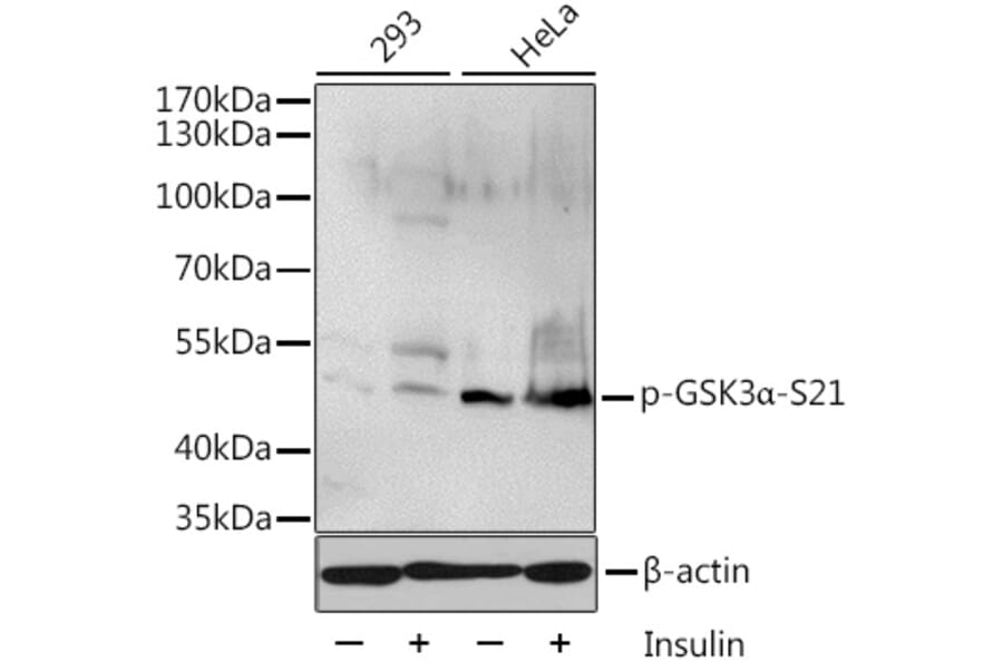 Western Blot - Anti-GSK3 alpha (phospho Ser21) Antibody (A11060) - Antibodies.com