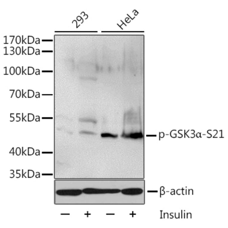 Western Blot - Anti-GSK3 alpha (phospho Ser21) Antibody (A11060) - Antibodies.com