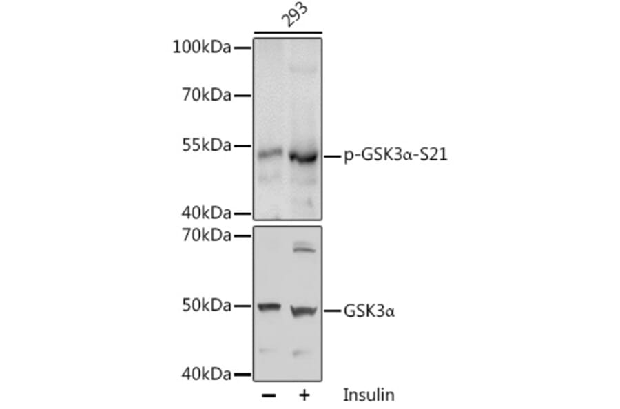 Western Blot - Anti-GSK3 alpha (phospho Ser21) Antibody (A11060) - Antibodies.com