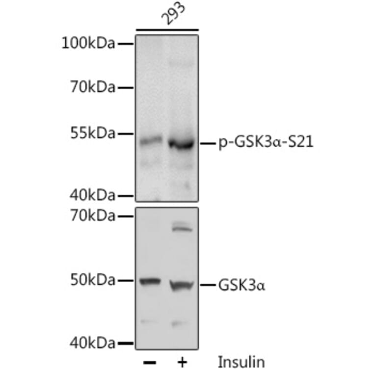 Western Blot - Anti-GSK3 alpha (phospho Ser21) Antibody (A11060) - Antibodies.com