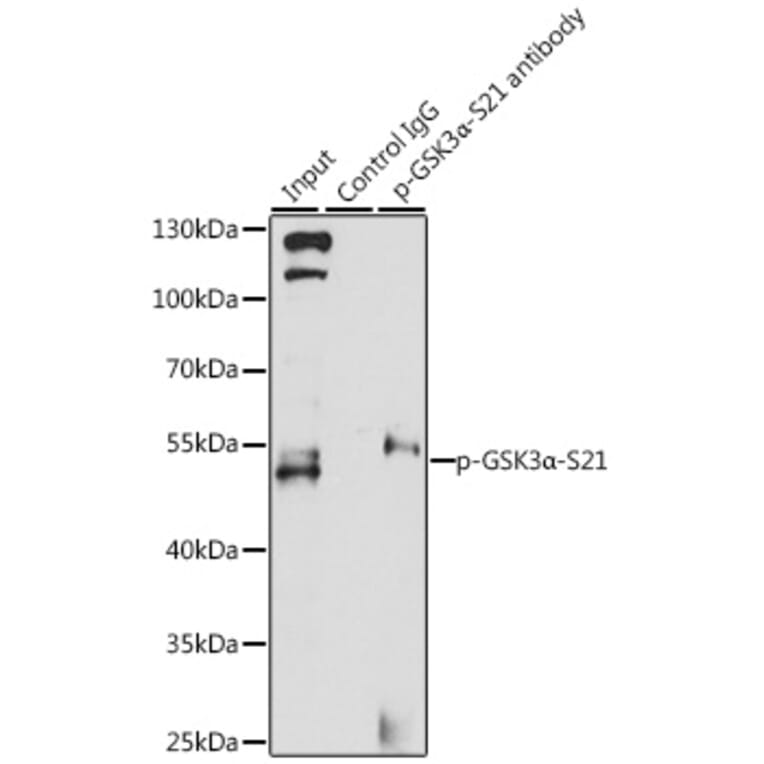 Western Blot - Anti-GSK3 alpha (phospho Ser21) Antibody (A11060) - Antibodies.com