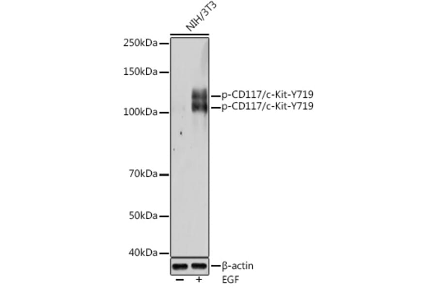 Western Blot - Anti-c-Kit (phospho Tyr719) Antibody (A11064) - Antibodies.com