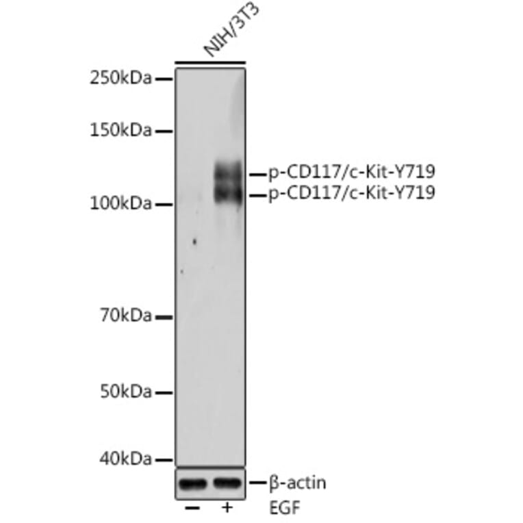 Western Blot - Anti-c-Kit (phospho Tyr719) Antibody (A11064) - Antibodies.com