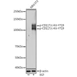 Western Blot - Anti-c-Kit (phospho Tyr719) Antibody (A11064) - Antibodies.com